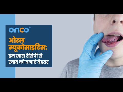 ओरल म्यूकोसाइटिस (Oral Mucositis): इन खास रेसिपी से  स्वाद को बनाएं बेहतर | Hindi | Onco