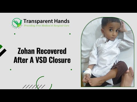 Zohan Ahmed’s Life-Saving Surgery was Successful