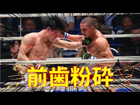 [閲覧注意] 朝倉未来が前歯を粉砕する激闘【RIZIN】