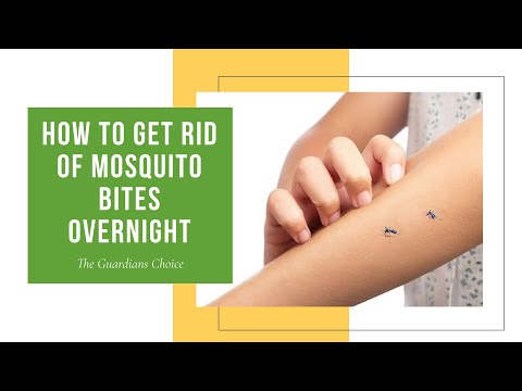 How to Get Rid of Mosquito Bites Overnight Home Remedies | The Guardians Choice