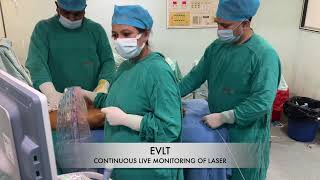 Endovenous Laser Ablation (EVLA) for #VaricoseVeins By Dr. Parul Garg [Call 9818697611]