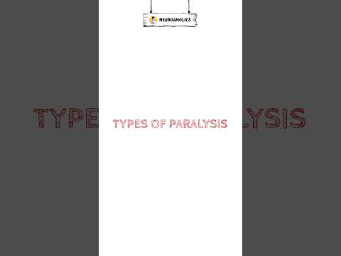 Patterns of upper motor neuron paralysis 🦵💪 #shorts #paralysis #weakness #shortvideo