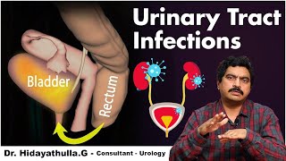 What are the Symptoms of Urinary Tract Infection || Urine Infection | Dr Hidayatullah | TX Hospitals