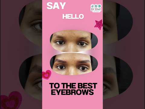 How to get the perfect eyebrows |Eyebrows before and after | Best dermatologist in bangalore