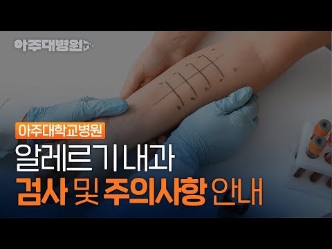 아주대병원 알레르기 내과 '검사 및 주의사항' 안내 [아주대병원TV]