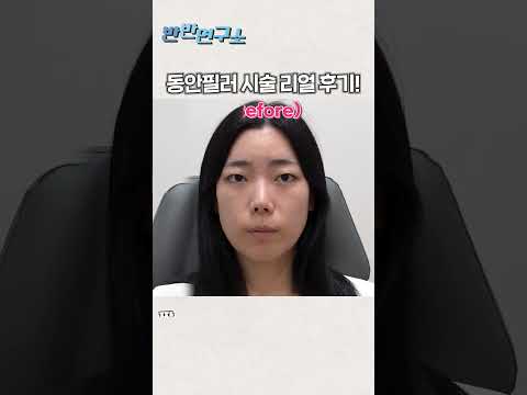 [반반연구소] 동안필러 효과가 이정도라고? 실제 리얼 모델 후기 대공개!