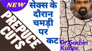 Sex ke samay chamdi kat jana | Prepuce Cuts | Painful foreskin \Bleeding | Reasons and treatment