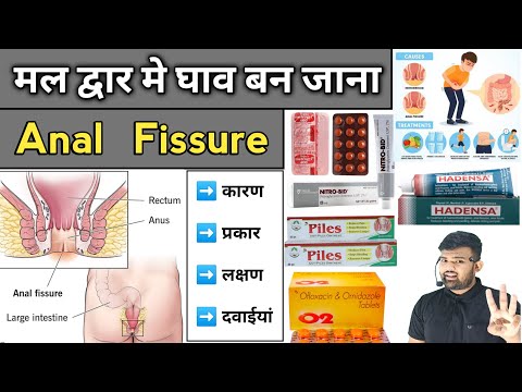 Anal Fissure | गुदा में घाव होना | Medicine | Treatment | Doctor | Pharmacy | Medicine knowledge