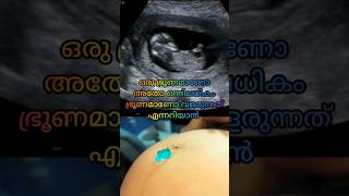 ആദ്യ സ്കാനിലൂടെ പ്രസവ തീയതി അറിയാൻ സാധിക്കുന്നു..🤰pregnancy