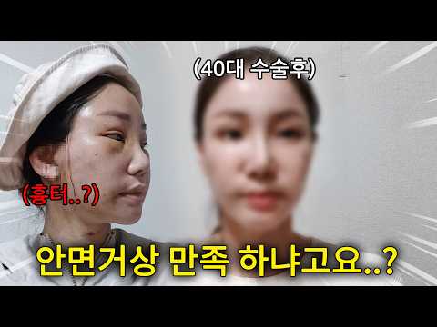 한 살이라도 어릴 때 예쁘면 좋잖아요?😉 | 40대 안면거상 솔직 Q&A💥 [미래Vlog]