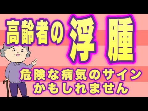 高齢者に多い浮腫を解説！病気のサインかもしれません！