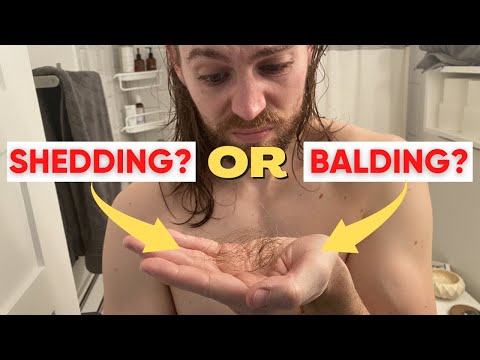 Are You Shedding Or Balding? (Telogen Effluvium Vs Male Pattern Baldness)