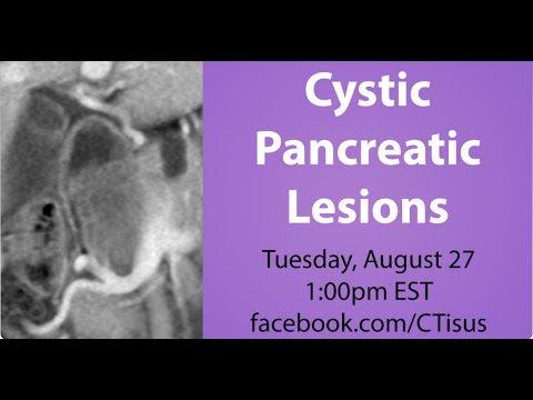 Facebook Live: Cystic Pancreatic Lesions