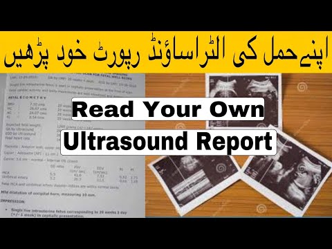 Read Your Anomaly scan Ultrasound Report at home In Urdu |Hindi Obstetrics ultrasound report reading