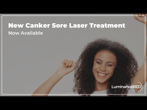 New Canker Sore Laser Treatment Now Available