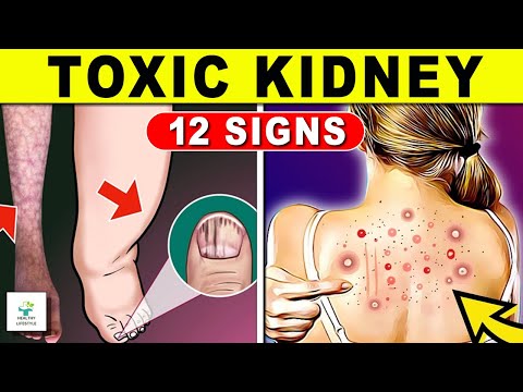 👉12 Signs Your Kidneys Are Having Problems And Your KIDNEYS Are Dying - Healthy lifestyle