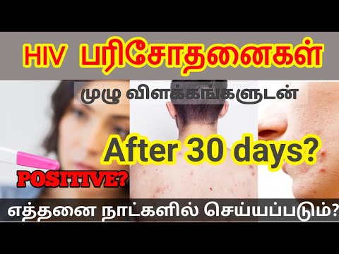 HIV Test in tamil/AIDS symptoms in Tamil/AIDS in Tamil/aids explained tamil/hiv symptoms tamil