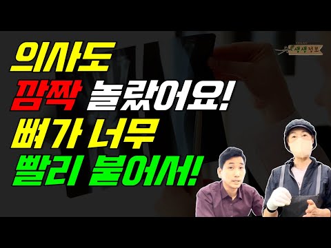 의사도 깜짝 놀랐어요! 뼈가 빨리 붙어서!