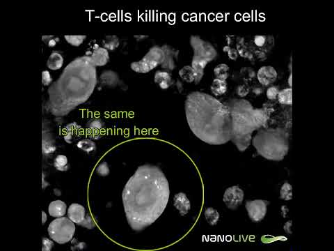 Label-free Live Cell Imaging: T-cells killing colon cancer cells