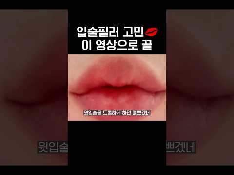 입술필러에도 트렌드가 있다?