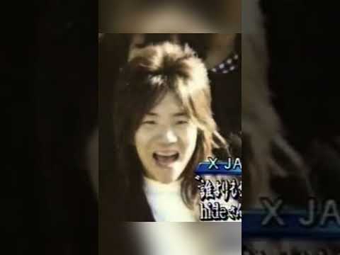 肥満児の男の子が音楽に出会った結果… #hide #xjapan #shorts