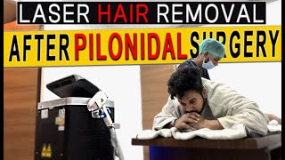 LASER HAIR REMOVAL AFTER PILONIDAL SINUS SURGERY EXPERIENCE | COST & FEEDBACK HAIR LASER REDUCTION