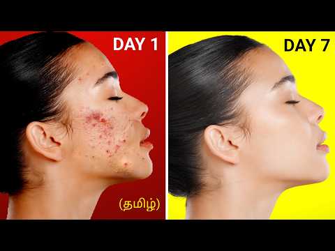 7 Days Face Glowing challenge (Boys & Girls) | 5 Natural Home remedies for clear skin