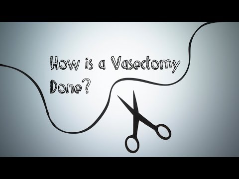 How is a vasectomy done?