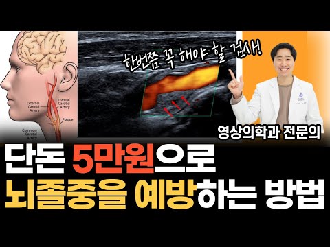 가성비 최강 혈관 검사 l 경동맥 초음파에 대한 모든 것 [닥터인사이드]