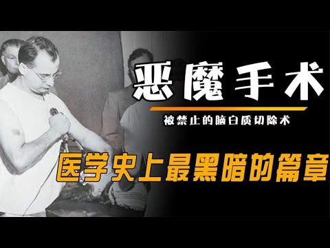 被禁止的恶魔手术，医学史上最黑暗的篇章，脑白质切除术