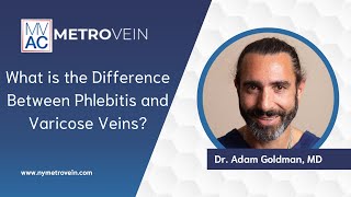 What is the Difference Between Phlebitis and Varicose Veins?