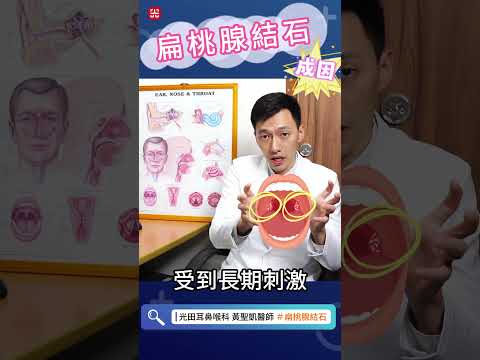 你也有這個壞習慣嗎？揭開扁桃腺結石罪魁禍首！#扁桃腺 #扁桃腺結石 #扁桃腺炎  #耳鼻喉頭頸部 #光田醫院 #黃聖凱醫師