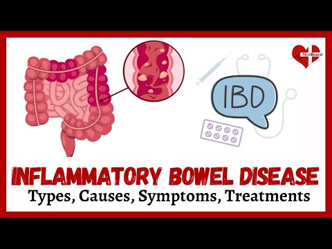 What is IBD? Inflammatory Bowel Disease Explanation