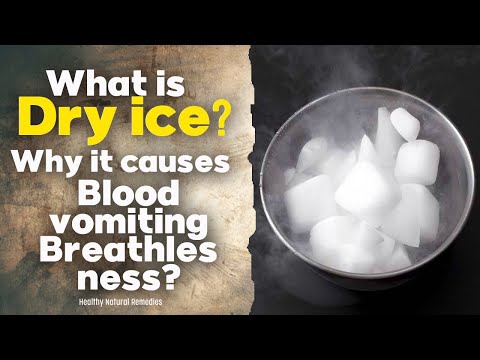 What is dry ice and why it causes blood vomiting, swelling, abdominal pain, Breathlessness? Health