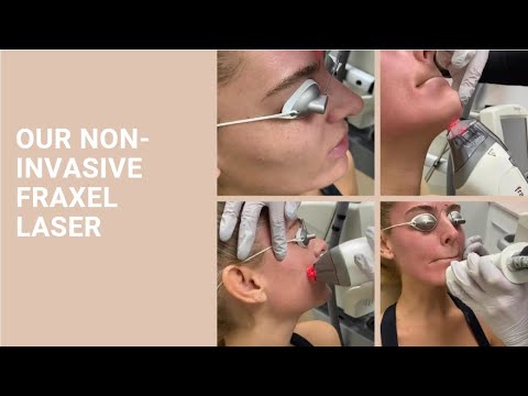 Our Non-Invasive Fraxel Laser