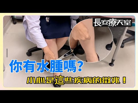 你有水腫嗎? | 腎臟科楊雅斐醫師