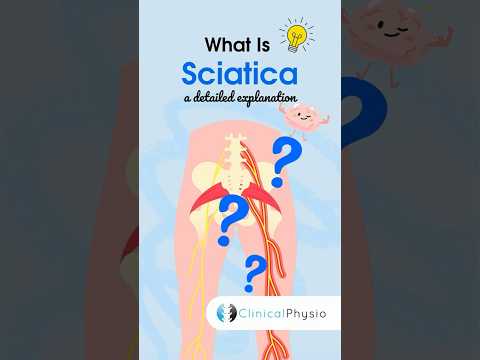 What is Sciatica #physicaltherapy #physiotherapy #sciatica #sciaticnervepain #sciaticapain