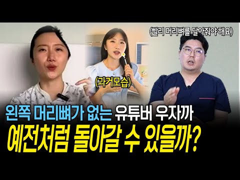 충격 사고로 왼쪽 머리뼈가 없는 여자...수술하면 예전처럼 돌아갈 수 있을까? | 의학 전문채널