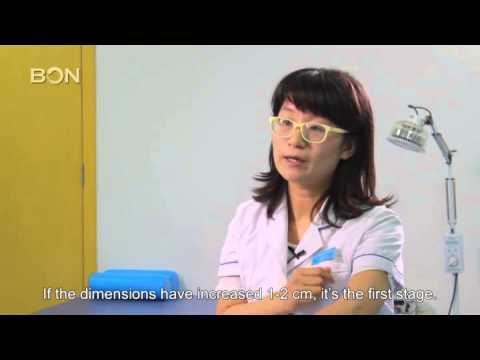 TCM rehabilitation treatment for breast cancer