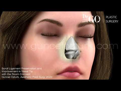 Nasen Let Down & Push Down Preservation Rhinoplasty Operation - Guncel Ozturk M.D. #DRGO