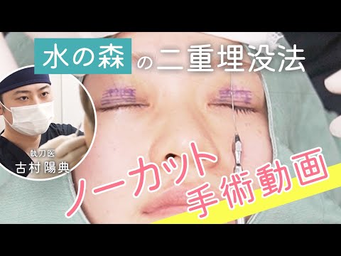 【手術動画】水の森の二重埋没手術に密着！