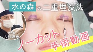 【手術動画】水の森の二重埋没手術に密着！