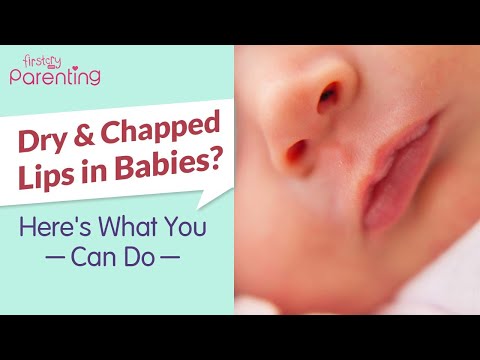 6 Easy Home Remedies for Baby's Chapped | Home Remedies for Dry Lips In Babies