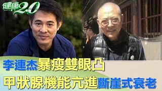 李連杰暴瘦雙眼凸 甲狀腺機能亢進斷崖式衰老 健康2.0