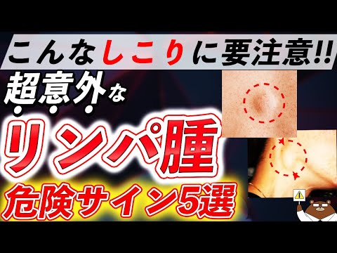 体にこんな「しこり」があったら絶対見逃さないで！悪性リンパ腫は「寝汗」でわかる？日本で一番多い血液がんの正体とは。初期の危険サインとは？医師が徹底解説！