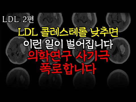 난 니가 콜레스테롤에 한짓을 알고있다 [LDL과 심혈관질환 2편]