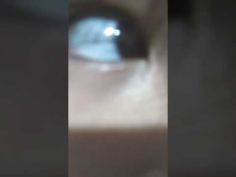 Rate my eye