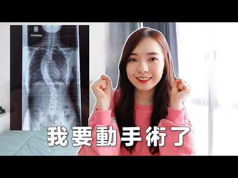 【脊椎側彎】我決定動手術了 Scoliosis Surgery ｜Stephy Yiwen