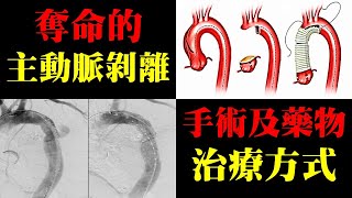 奪命的主動脈剝離，手術及藥物的治療方式｜許原彰醫師