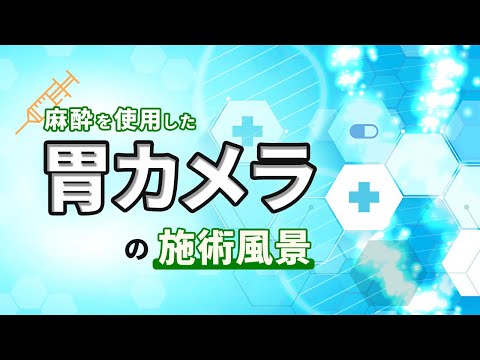 大宮エヴァグリーンクリニック、池袋消化器内科・泌尿器科クリニックの静脈麻酔ミタゾラムを使用した眠ったまま出来る胃カメラ(上部消化管内視鏡)の動画です。